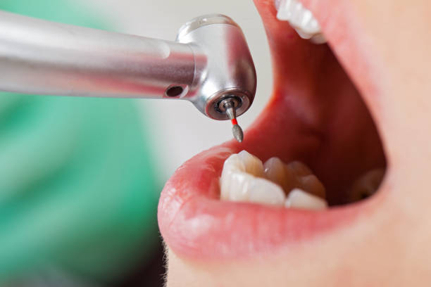 Best Emergency Dental Care for Broken or Chipped Teeth in Park City, IL